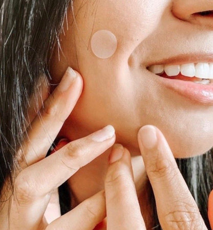 Acne Patch – 36 Patches Per Sheet | Overnight Pimple Healing Stickers