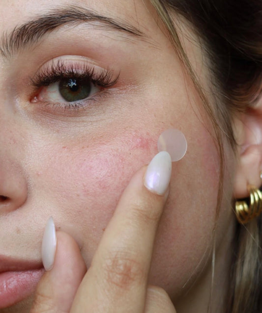 Acne Patch – 36 Patches Per Sheet | Overnight Pimple Healing Stickers